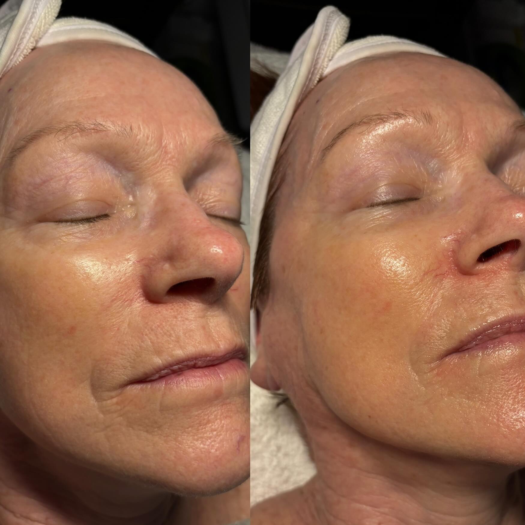 Waxing Near Me in League City: Smooth, Gentle, Licensed